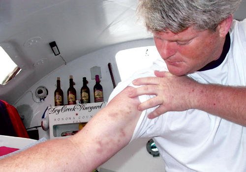 To repair the gennaker halyard, a line that hoists the sails, Brad climbs solo to the top of his mast. His bruised arms document the rough nature of such an endeavor.